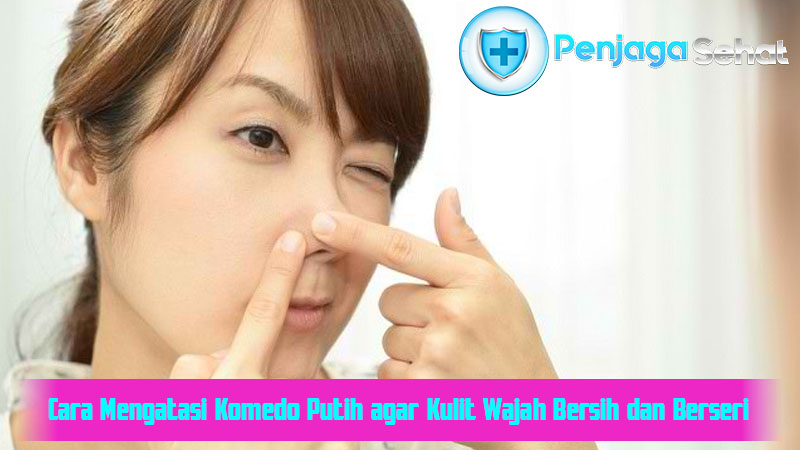 Cara Mengatasi Komedo Putih agar Kulit Wajah Bersih dan Berseri