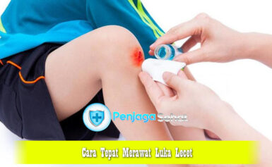Cara Tepat Merawat Luka Lecet