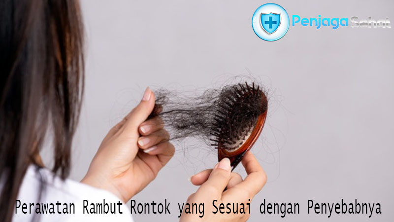 Perawatan Rambut Rontok yang Sesuai dengan Penyebabnya