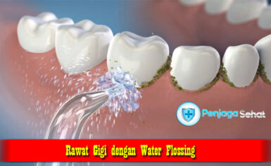 Rawat Gigi dengan Water Flossing