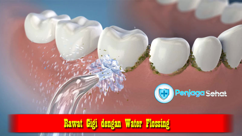 Rawat Gigi dengan Water Flossing