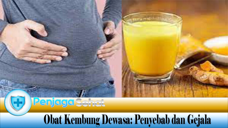 Obat Kembung Dewasa: Penyebab dan Gejala