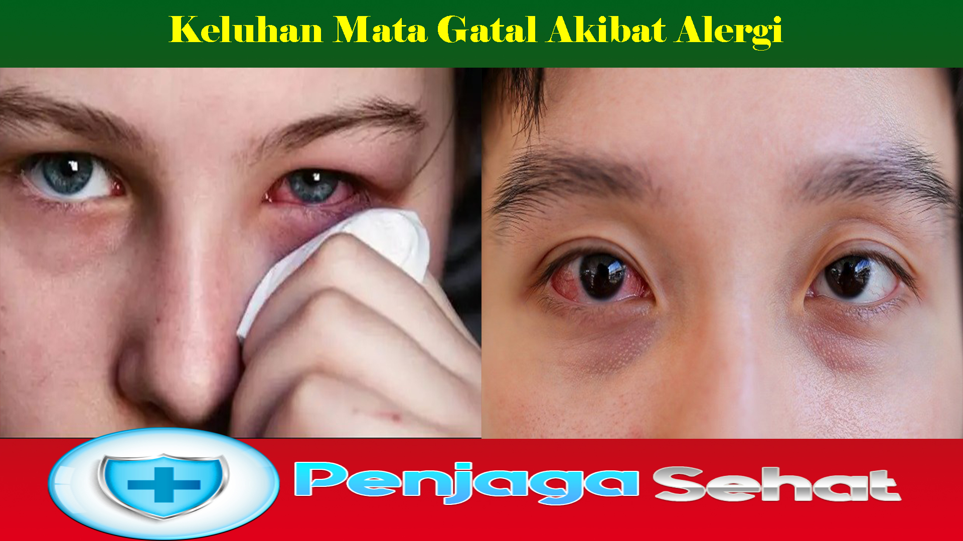 Keluhan Mata Gatal Akibat Alergi