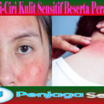 Kenali Ciri-Ciri Kulit Sensitif Beserta Perawatannya
