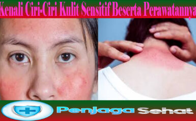 Kenali Ciri-Ciri Kulit Sensitif Beserta Perawatannya