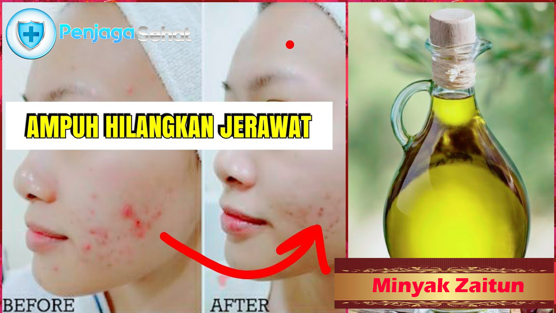 Ini Manfaat Minyak Zaitun untuk Wajah Berjerawat